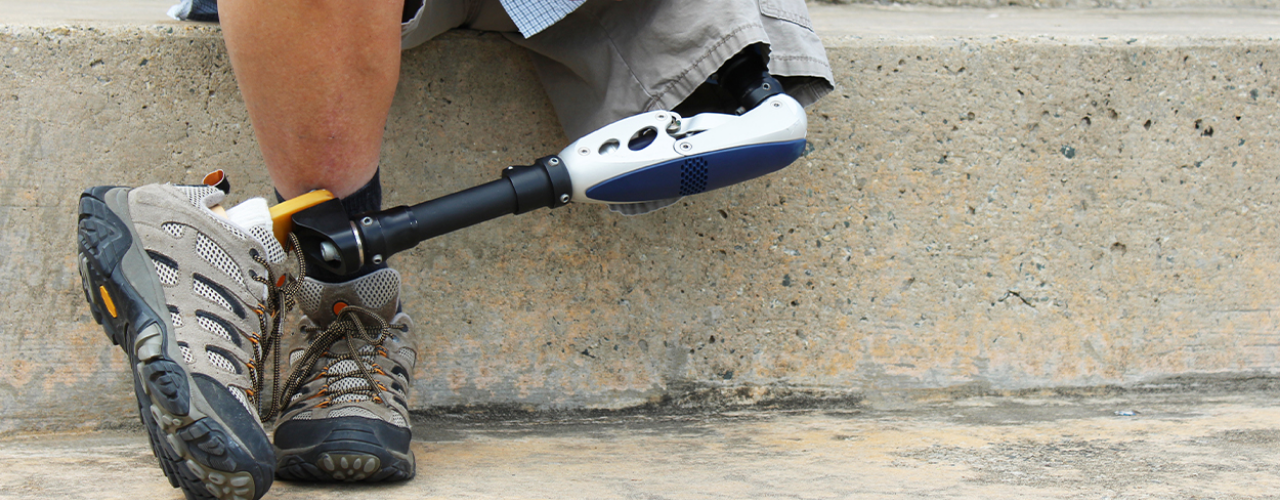 Amputations-Optimal-Home-Rehab-Philadelphia-Delaware-Montgomery-PA